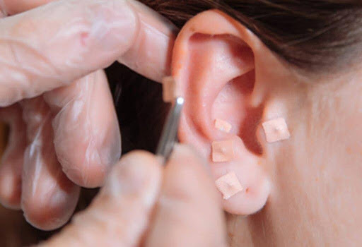 unnamed 19 Refúgio Refúgio